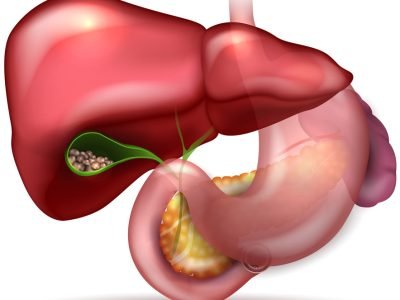 gall-bladder-stone-treatment-in-bangalore