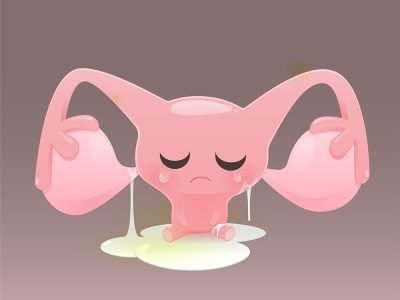 Uterus cartoon sadness because of leucorrhoea, Symptoms of genital fungal infections, The weakness of the physique. Vector flat character illustration design